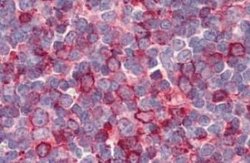 GPR26 Antibody, Novus Biologicals 50 &mu;g; Unconjugated:Antibodies, Polyclonal